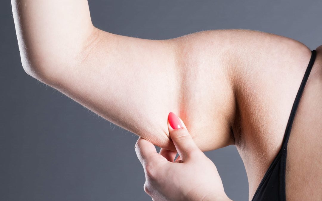 Put an End to Loose Hanging Arm Skin With RF Skin Tightening