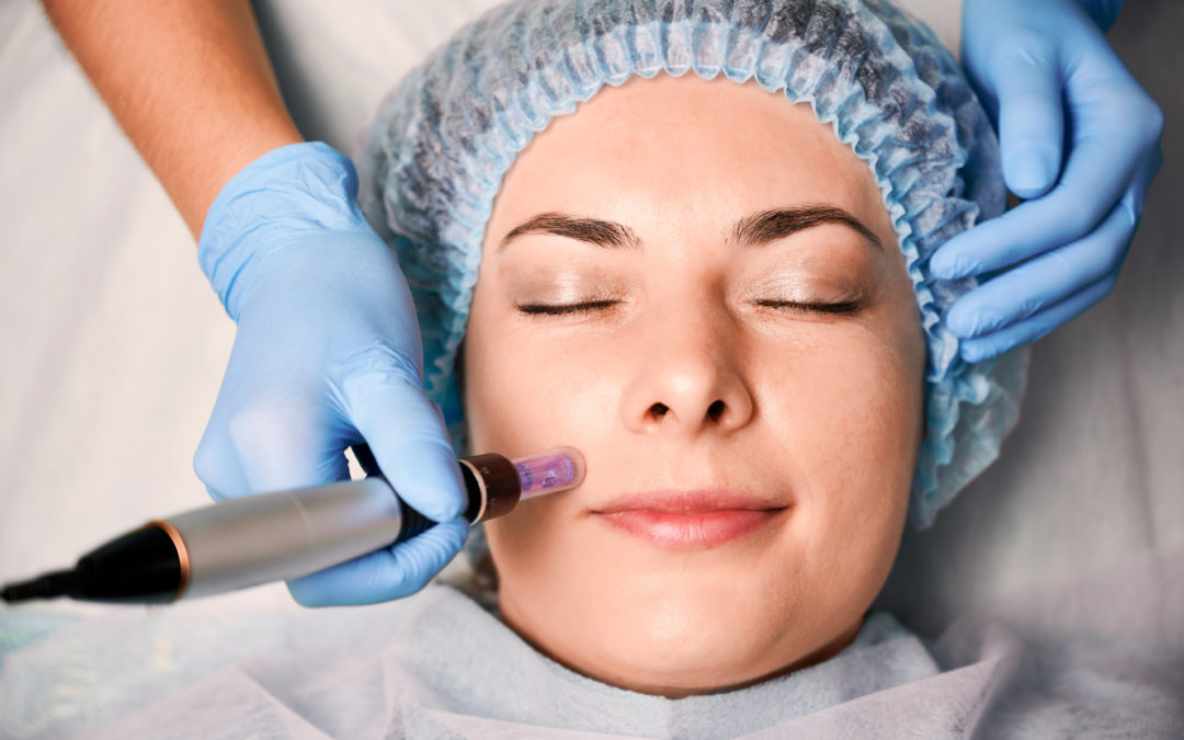 Exosome Therapy and Microneedling